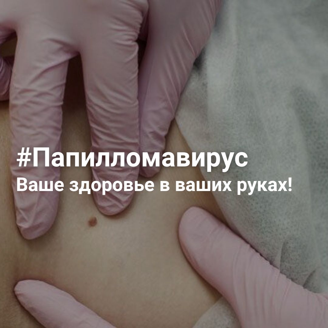 #Папилломавирус